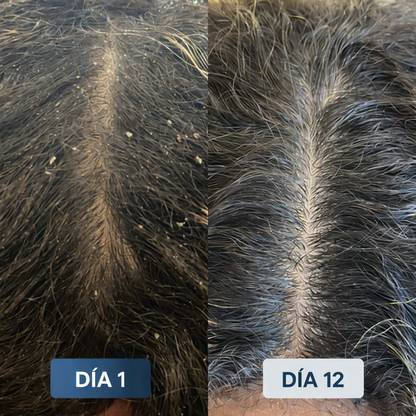 VELIA™ Cabezal de ducha purificador